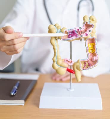 Management of Esophageal, Gastric, and Colonic Bleeding