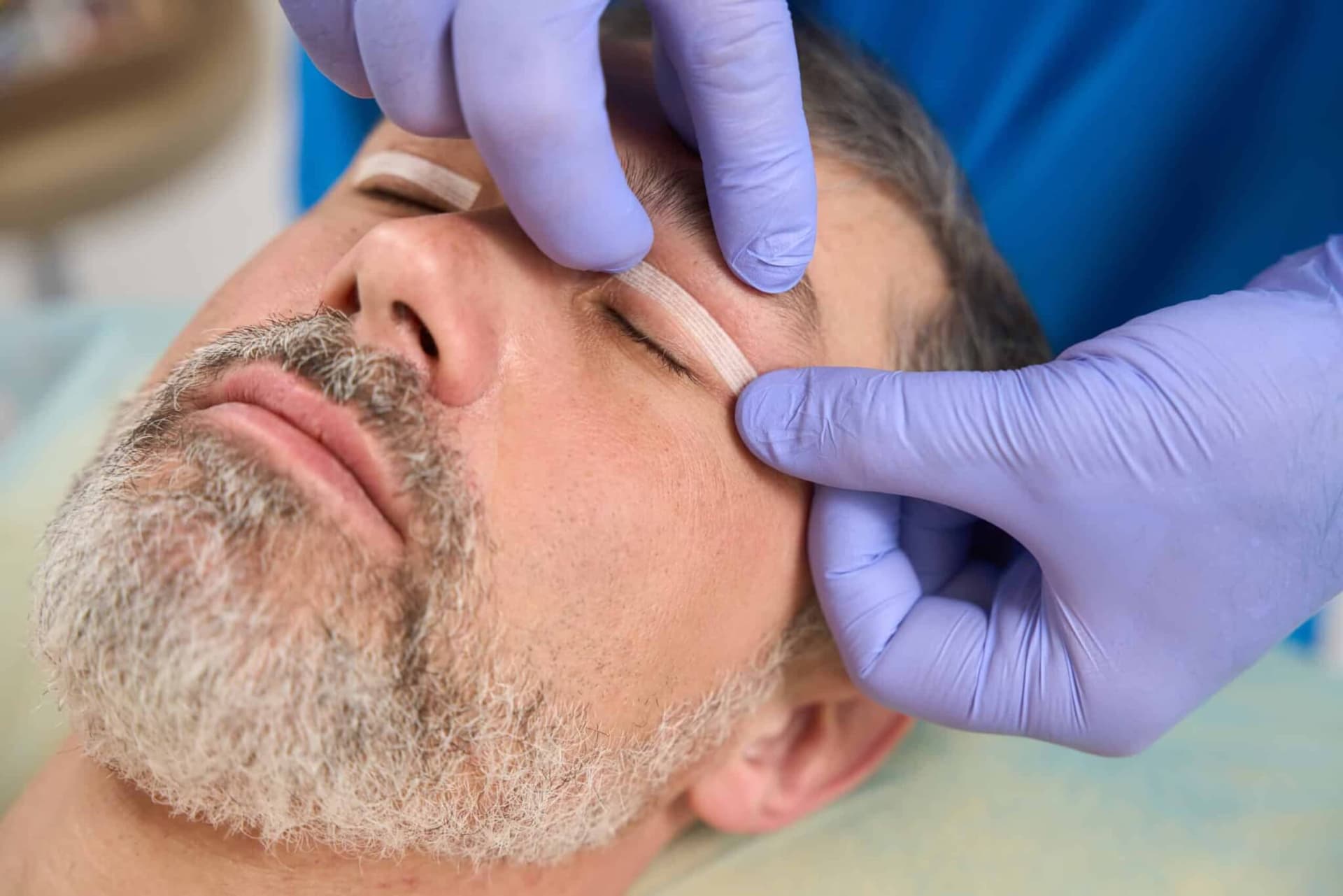 جراحة تجميل الجفون