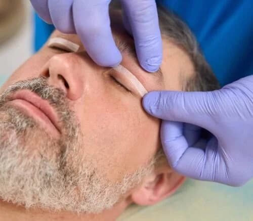 Eyelid Surgery