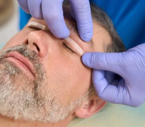 Eyelid Surgery