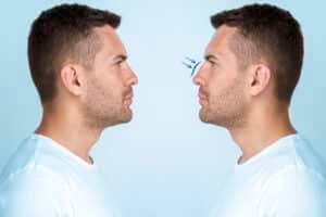 Rhinoplasty - Case 1 | Emirates European Hospital
